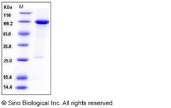 Sino Biological Recombinant Human HDAC8 Protein (GST Tag), Quantity: Each