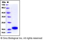 Sino Biological Recombinant Human PLA2G1B Protein (His Tag), Quantity: