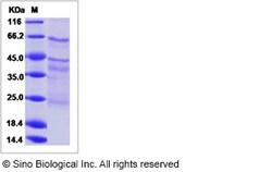 Sino Biological Human EGFL6 / EGF-L6 Protein (Flag & His Tag) 100ug, Quantity: