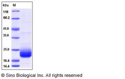 Sino Biological Recombinant Human LAIR2 Protein, HPLC-verified, Quantity: