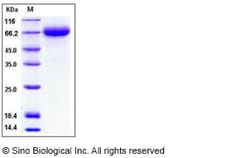 Sino Biological Human Hemopexin / HPX Protein (His Tag) 100ug, Quantity: