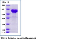 Sino Biological Recombinant Human TNFR1/CD120a Protein (ECD, hFc Tag),