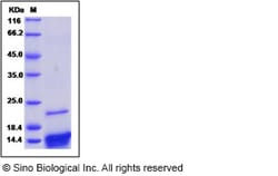 Sino Biological Recombinant Human CXCL4/PF4 Protein 1 mg, Quantity: Each