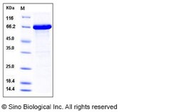 Sino Biological Human CXCL1 / MGSA / NAP-3 Protein (His & NusA Tag) 50ug,