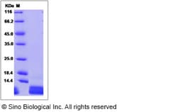 Sino Biological Recombinant Human CXCL1 Protein 100 µg, Quantity: Each