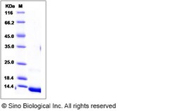 Sino Biological Recombinant Human CXCL7/NAP-2 Protein (His Tag), Quantity: