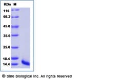 Sino Biological Recombinant Human CXCL17 Protein (His Tag) 1 mg, Quantity: