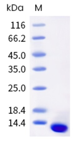 Sino Biological Human CXCL14 Protein 20ug (Sino Biological), Quantity: