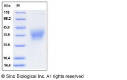 Sino Biological Human Ephrin-B2 / EFNB2 Protein (His Tag) 100ug, Quantity: