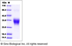 Sino Biological Recombinant Human Ephrin B2 Protein, Quantity: Each of