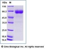 Sino Biological Recombinant Human CD200 Protein (ECD, hFc Tag), HPLC-verified,
