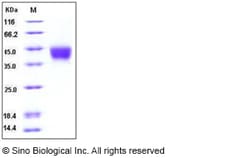 Sino Biological Recombinant Human CD200 Protein (His Tag), HPLC-verified,