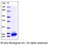Sino Biological Human CXCL9 / MIG / C-X-C motif chemokine 9 Protein 50ug,