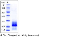 Sino Biological Recombinant Human BAMBI Protein (His Tag), Quantity: Each