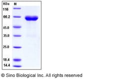 Sino Biological Recombinant Human Ephrin-B1 Protein (His & hFc Tag), Quantity: