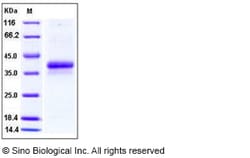 Sino Biological Recombinant Human Ephrin-B1 Protein (His Tag), Quantity: