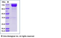 Sino Biological Human IL-17R / IL-17RA (CD217) Protein (Fc Tag) 100ug,