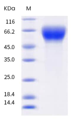 Sino Biological Human IL17RA Protein 20ug (Sino Biological), Quantity: