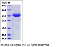 Sino Biological Recombinant Human Chorionic Gonadotropin/CGA Protein (mFc