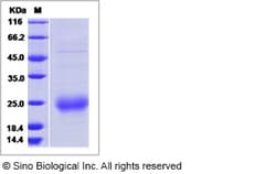 Sino Biological Recombinant Human Chorionic Gonadotropin/CGA Protein, Quantity: