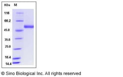 Sino Biological Recombinant Human CD39L3/ENTPD3 Protein (His Tag), Quantity: