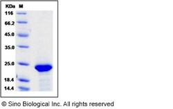 Sino Biological Human FGF21 Protein (His Tag) 50ug, Quantity: Each of 1
