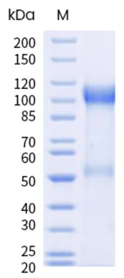 Sino Biological&nbsp;Recombinant Human Cadherin-16 Protein (His Tag), Biotinylated 100 µg