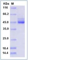 Sino Biological Recombinant Human TIGIT Protein (ECD, hFc Tag), HPLC-verified,