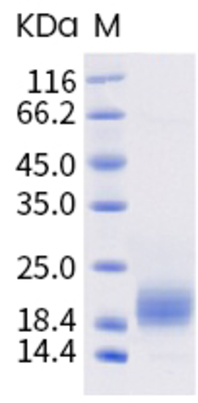 Sino Biological TIGIT Protein, Human, (ECD, His Tag) 50µg