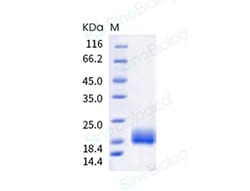 Sino Biological Recombinant Human TIGIT Protein (ECD, His Tag), HPLC-verified,