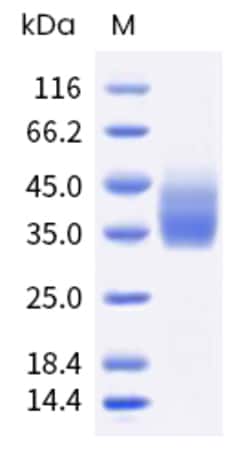 Sino Biological Human TIGIT Protein 500ug (Sino Biological), Quantity: