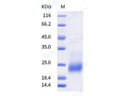 Sino Biological Recombinant Human TIGIT Protein (ECD, His & AVI Tag), Biotinylated,