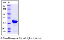 Sino Biological Recombinant Human Histone H1 Protein (His Tag), HPLC-verified,