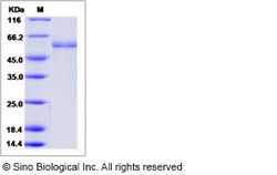 Sino Biological Human TIMP-1 / TIMP1 Protein (Fc Tag) 100ug, Quantity: