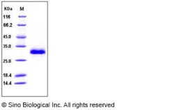 Sino Biological Recombinant Human TIMP-1 Protein (His Tag) 100, Quantity: