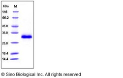 Sino Biological Recombinant Human TIMP-1 Protein (His Tag), Quantity: Each
