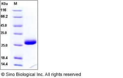 Sino Biological Recombinant Human TIMP-1 Protein, HPLC-verified 100, Quantity: