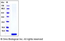 Sino Biological Human S100A6 / CACY Protein (His Tag) 50ug, Quantity: Each