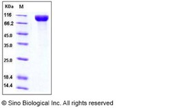 Sino Biological Recombinant Human IL-13 R alpha 1/IL13RA1 Protein (His