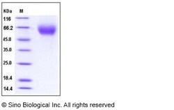 Sino Biological Recombinant Human IL-13 R alpha 1/IL13RA1 Protein (His