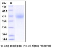 Sino Biological Recombinant Human IL-10RB/IL-10R beta Protein (His Tag),
