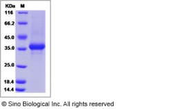 Sino Biological Recombinant Human Neuropeptide Y Protein (hFc Tag), Quantity: