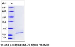 Sino Biological Recombinant Human IL-10 Protein (His Tag), Quantity: Each