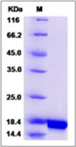 Sino Biological Human IL10 / Interleukin-10 Protein 100ug, Quantity: Each