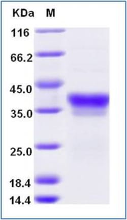 Sino Biological Recombinant Human IL-34 Protein (His Tag), Quantity: Each