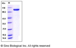 Sino Biological Recombinant Human Aconitase 1/ACO1 Protein (His Tag), Quantity: