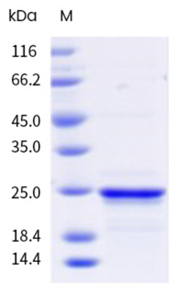 Sino Biological&nbsp;Recombinant Human Von Willebrand Factor/vWF Protein (His & AVI Tag), Avi-tag Biotinylated 20