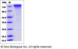 Sino Biological Human IL6ST / gp130 / CD130 Protein (ECD, Fc Tag) 10ug,