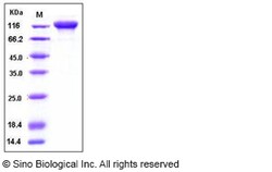 Sino Biological Recombinant Human gp130/IL6ST Protein (His & hFc Tag),