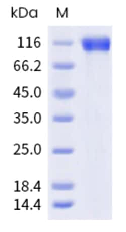 Sino Biological Human IL6ST Protein 100ug (Sino Biological), Quantity: